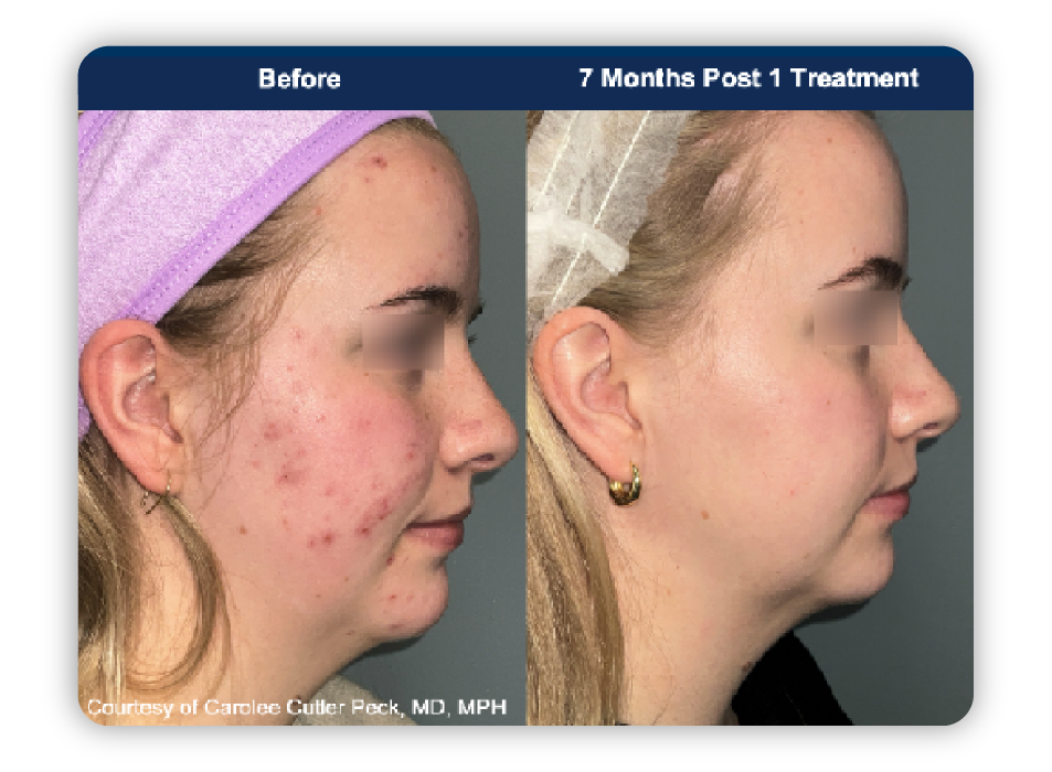 202604 before and after 2
